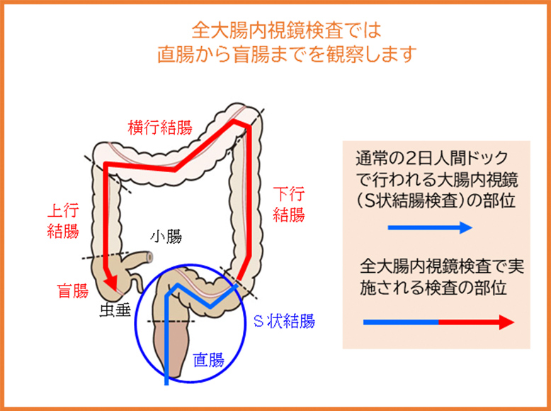 大腸内視鏡の図